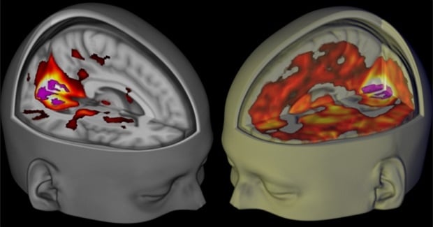 Groundbreaking Study Shows Your Brain (Though Perhaps Not Your Ego) on LSD