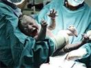 Money May Be Motivating Doctors To Do More C-Sections