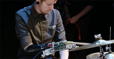 This Incredible Drummer Has a Robotic Hand and Inspirational Story