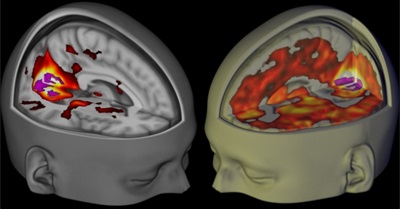 Groundbreaking Study Shows Your Brain (Though Perhaps Not Your Ego) on LSD