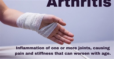 Knee Cartilage Transplants