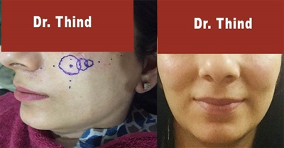 cosmetic surgeons in amritsar