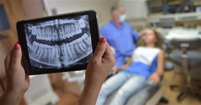 Get To Know The Benefits Of Low Exposure Digital X-Rays